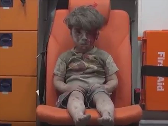Петогодишњи дјечак, који је извучен из рушевина послије разорних ваздушних удара на Алепо - Фото: Screenshot/YouTube