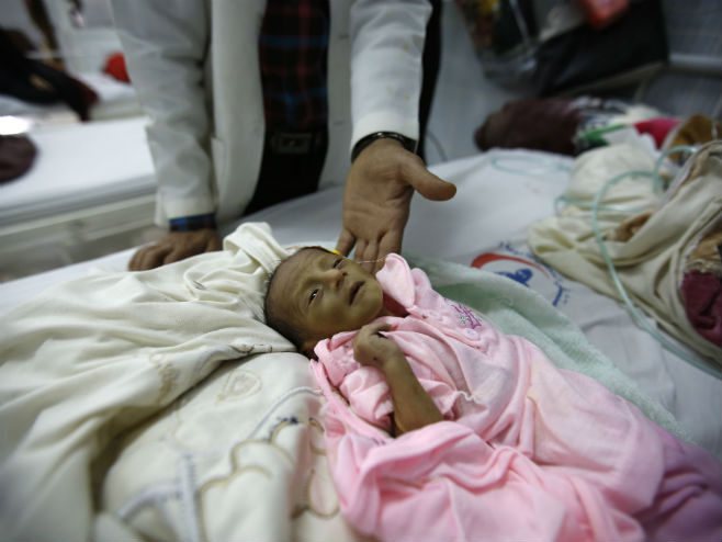 У Јемену од глади умиру дјеца (Фото: Business Insider) - 