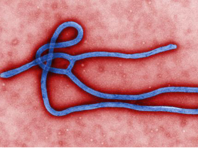Вирус еболе - Фото: Beta/AP