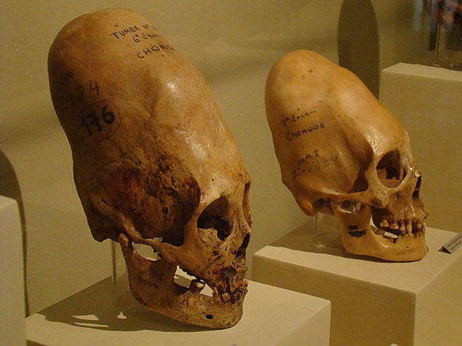 Лобање "ванземаљаца?" пронађене у старим гробницама у Перуу
(Фото:cont.ws) - 