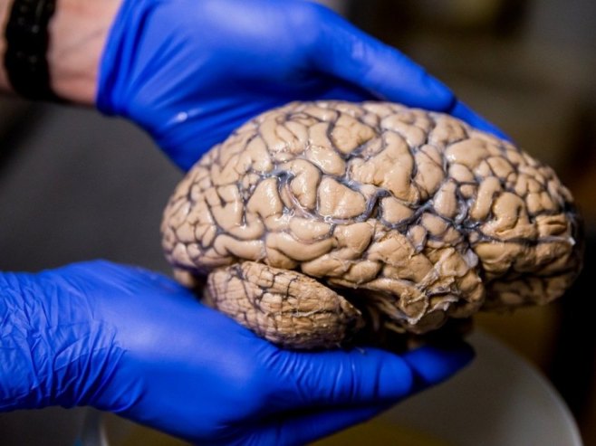 Мозак пролази кроз пет фаза током људског живота