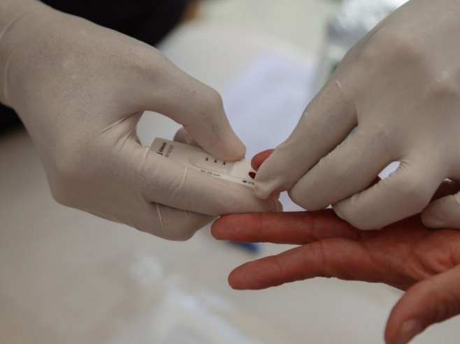 СЗО: ХИВ регистрован код 1,3 милиона особа у 2024. год, од сиде преминуло 630.000