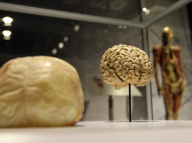 Мозак може да задржи одређени степен свијести сатима након смрти